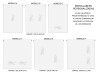 Enrollables de Screen Bordados